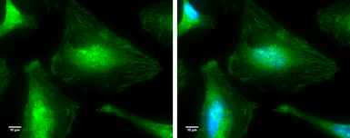 p38 MAPK antibody [N1C3-2]