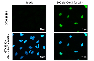 HIF1 alpha antibody [GT10211]