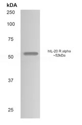 IL20 Receptor alpha antibody [