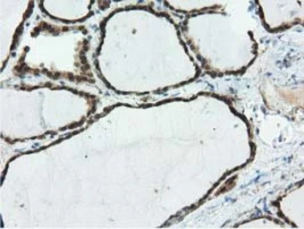 Ribonuclease Inhibitor antibod
