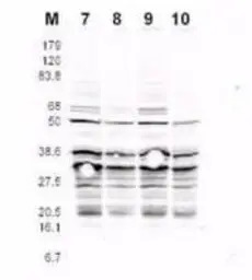 Rfa2 (phospho Ser122) antibody