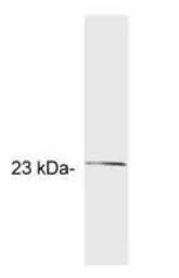 GCAP2 antibody [A1]