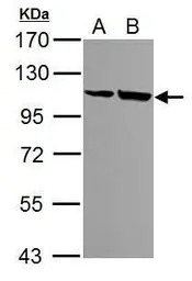 alpha Actinin 4 antibody [N1N2