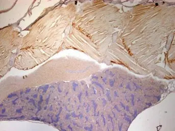 ENO1 antibody [N3C3]