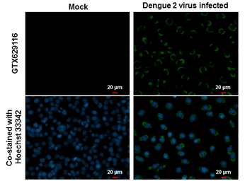 Dengue virus Envelope protein 