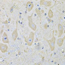 EphA2 antibody