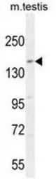 c-Kit antibody, N-term