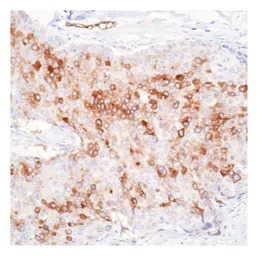 RPSA antibody [MLuC5]