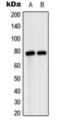 MASP2 antibody