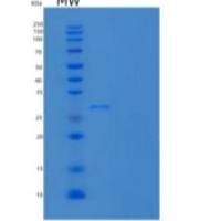 人泛素结合酶E2 R2/UBE2R2/UBC3B重组蛋白N-6His