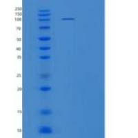 人肝细胞生长因子受体/HGF受体/cMet重组蛋白C-Fc