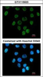 CARP antibody [N3C3]