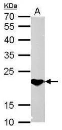 SOCS1 antibody