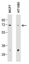 MMP2 antibody [F14 P4 D3]