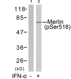 Merlin (phospho Ser518) antibo