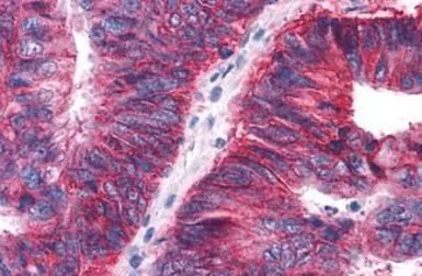 Apelin Receptor antibody