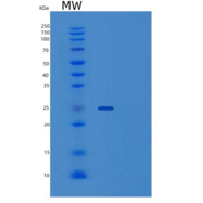人泛素羧基末端水解酶同工酶L1/UCH-L1重组蛋白C-6H