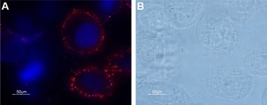 Thrombin Receptor antibody