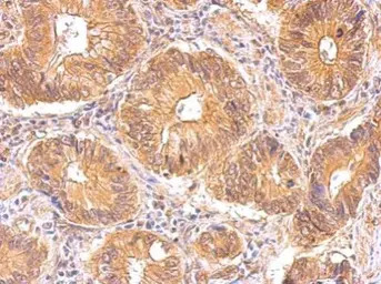 Insulin Receptor antibody