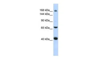 ABCC9 antibody, Internal