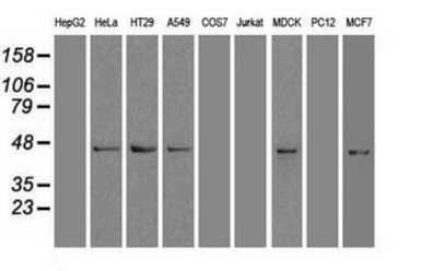 SOX17 antibody [3H5]