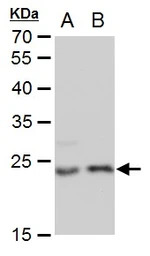 LIN7A antibody [GT879]