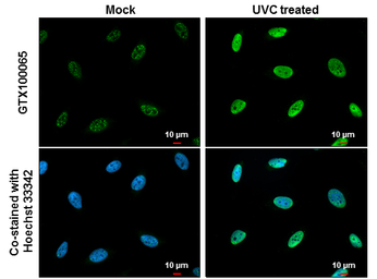 Chk1 (phospho Ser345) antibody