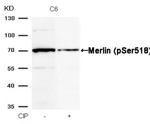 Merlin (phospho Ser518) antibo