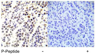 Histone H3S28ph (phospho Ser28