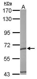 TCP1 epsilon antibody [N1C1]