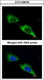 MTMR9 antibody [C3], C-term