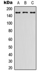 Latrophilin 2 antibody