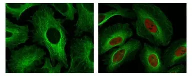 HIF1 alpha antibody [GT10211]