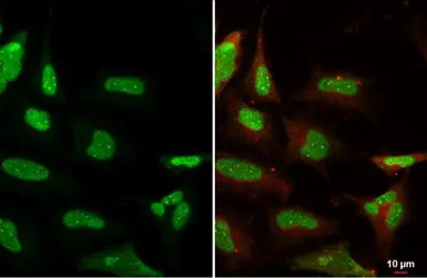 Ku80 antibody [9403]