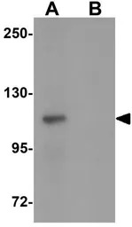 VPS39 antibody