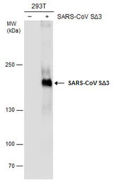 SARS-CoV Spike (SΔ3) antibody 