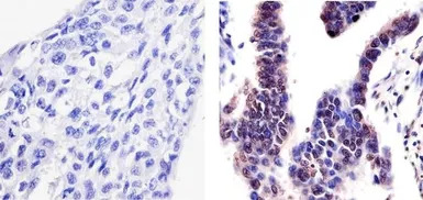 PYK2 (phospho Tyr402) antibody