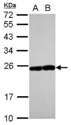 RAB17 antibody [N1C3]