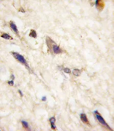 EphA5 antibody