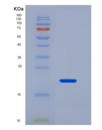 小鼠碱性成纤维细胞生长因子(FGF2)重组蛋白