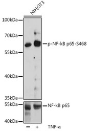 NFkB p65 (phospho Ser468) anti