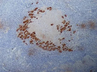 Progesterone antibody [9B4]