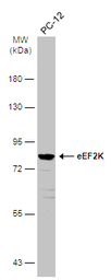 eEF2K antibody [N1N3]