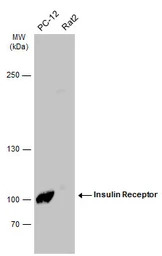 Insulin Receptor antibody