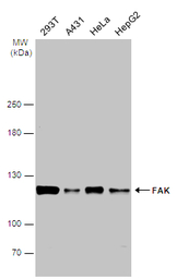 FAK antibody