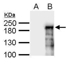 ASXL1 antibody