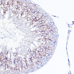 Integrin alpha V antibody