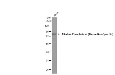 Alkaline Phosphatase (Tissue N