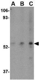 SP110 antibody