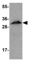 Apolipoprotein A1 antibody